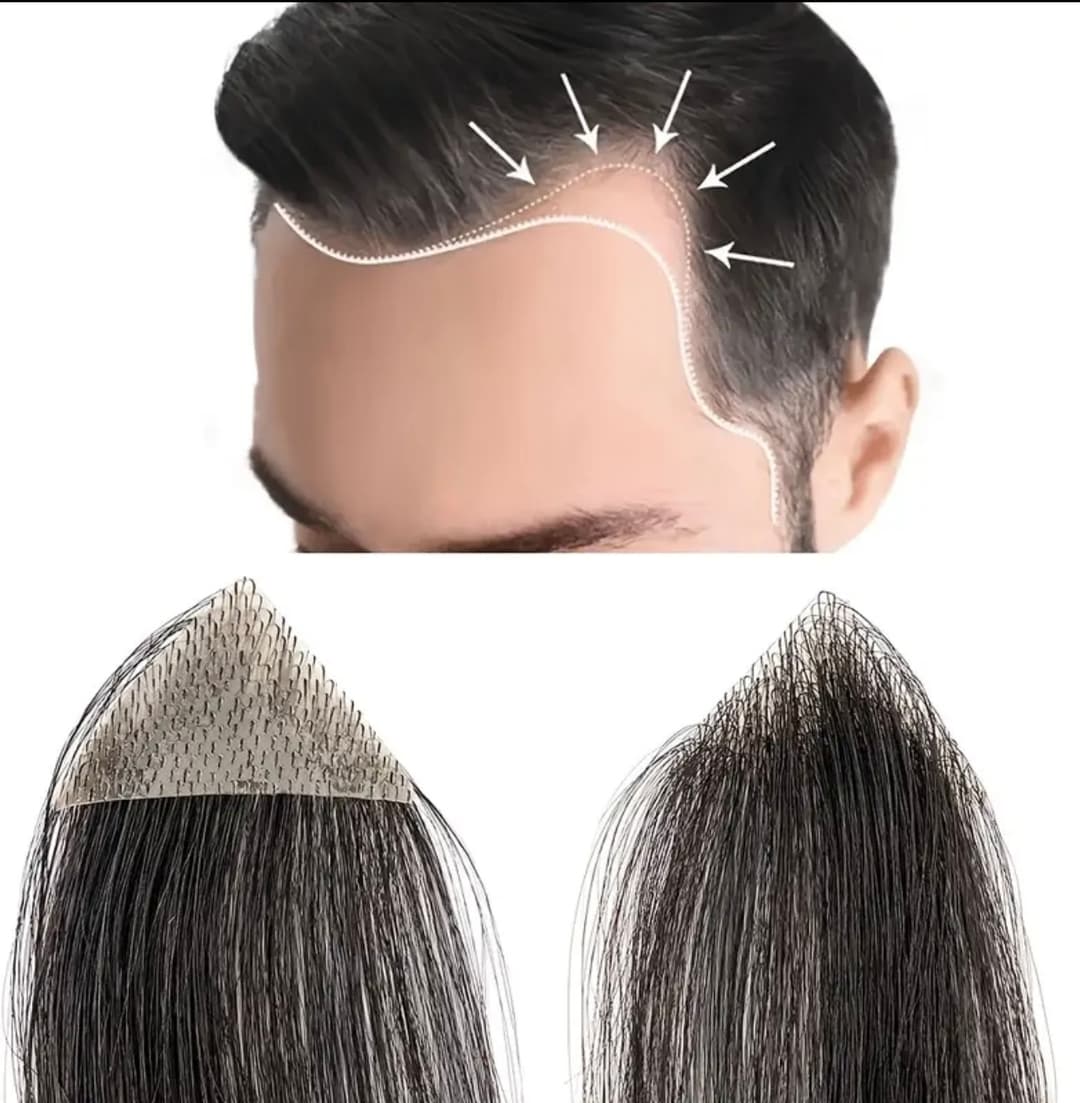 Mesa pentru Alopecie